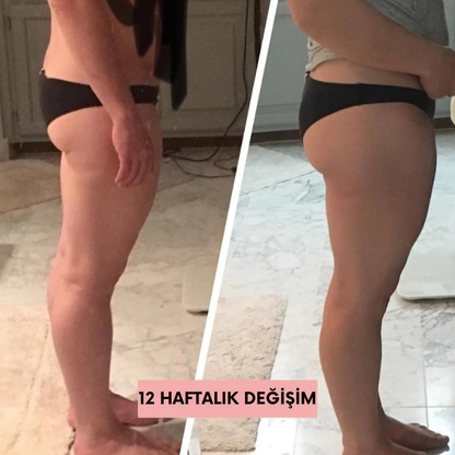 Ortopedya™ Kalça Şekillendirici