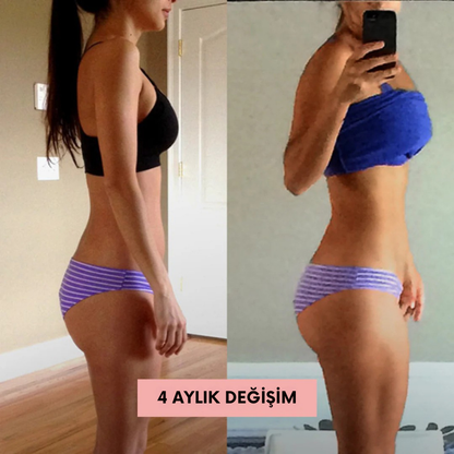 Ortopedya™ Kalça Şekillendirici