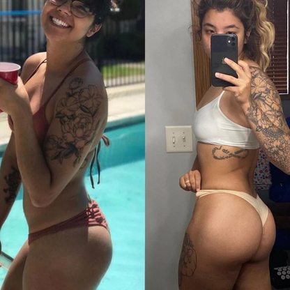 Ortopedya™ Kalça Şekillendirici