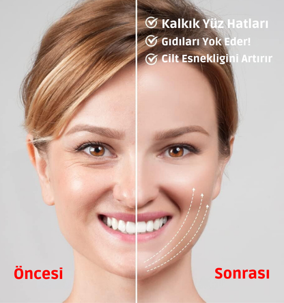 Ortopedya™ Beauty Face Lifting Cihazı (Gıdılara Elveda)