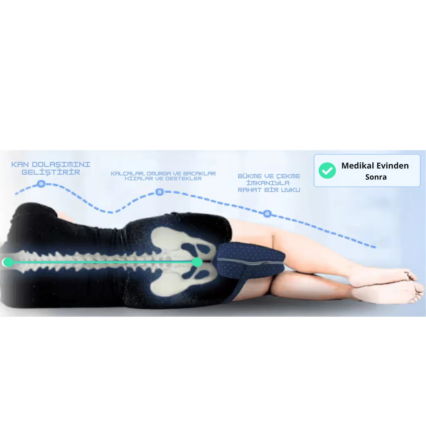 Ortopedya™ Ultra Rahat Uyku Diz Yastığı (Siyatik & Hamile & Bel Ağrıları)