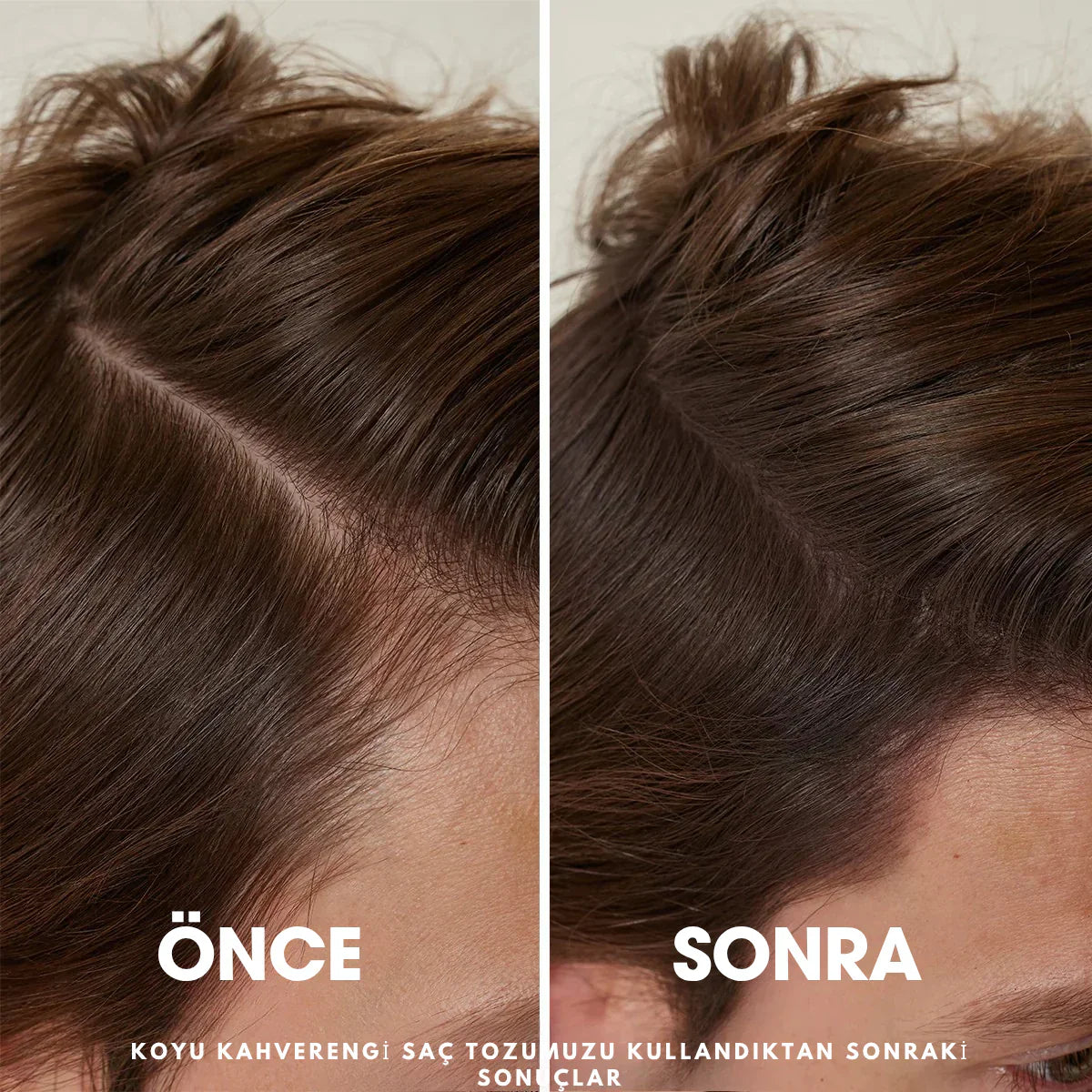 Ortopedya™ Root'd™ Saç Kök Güçlendirici Kapatıcı Pudra (48 Saat Kalıcı Etki)