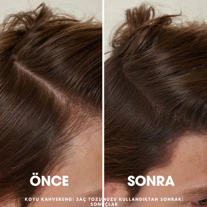 Ortopedya™ Root'd™ Saç Kök Güçlendirici Kapatıcı Pudra (48 Saat Kalıcı Etki)