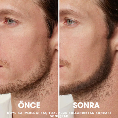 Ortopedya™ Root'd™ Saç Kök Güçlendirici Kapatıcı Pudra (48 Saat Kalıcı Etki)