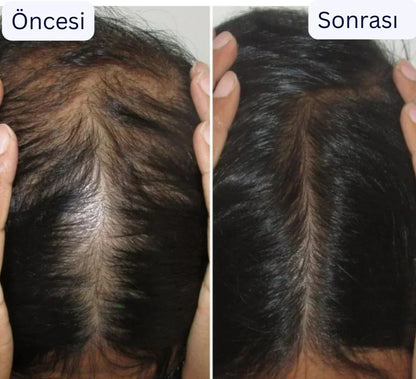 Ortopedya™ Saç Derisi Masaj aleti