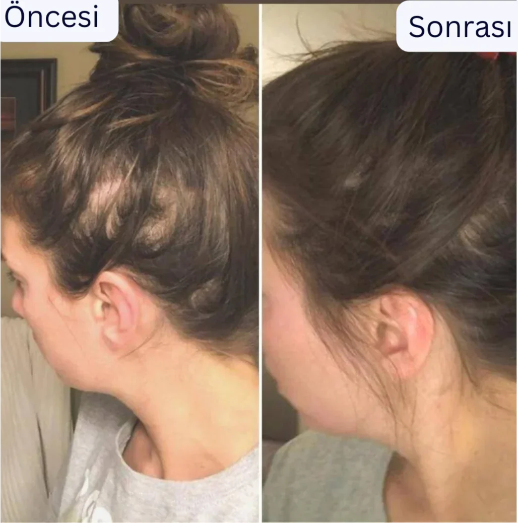 Ortopedya™ Saç Derisi Masaj aleti