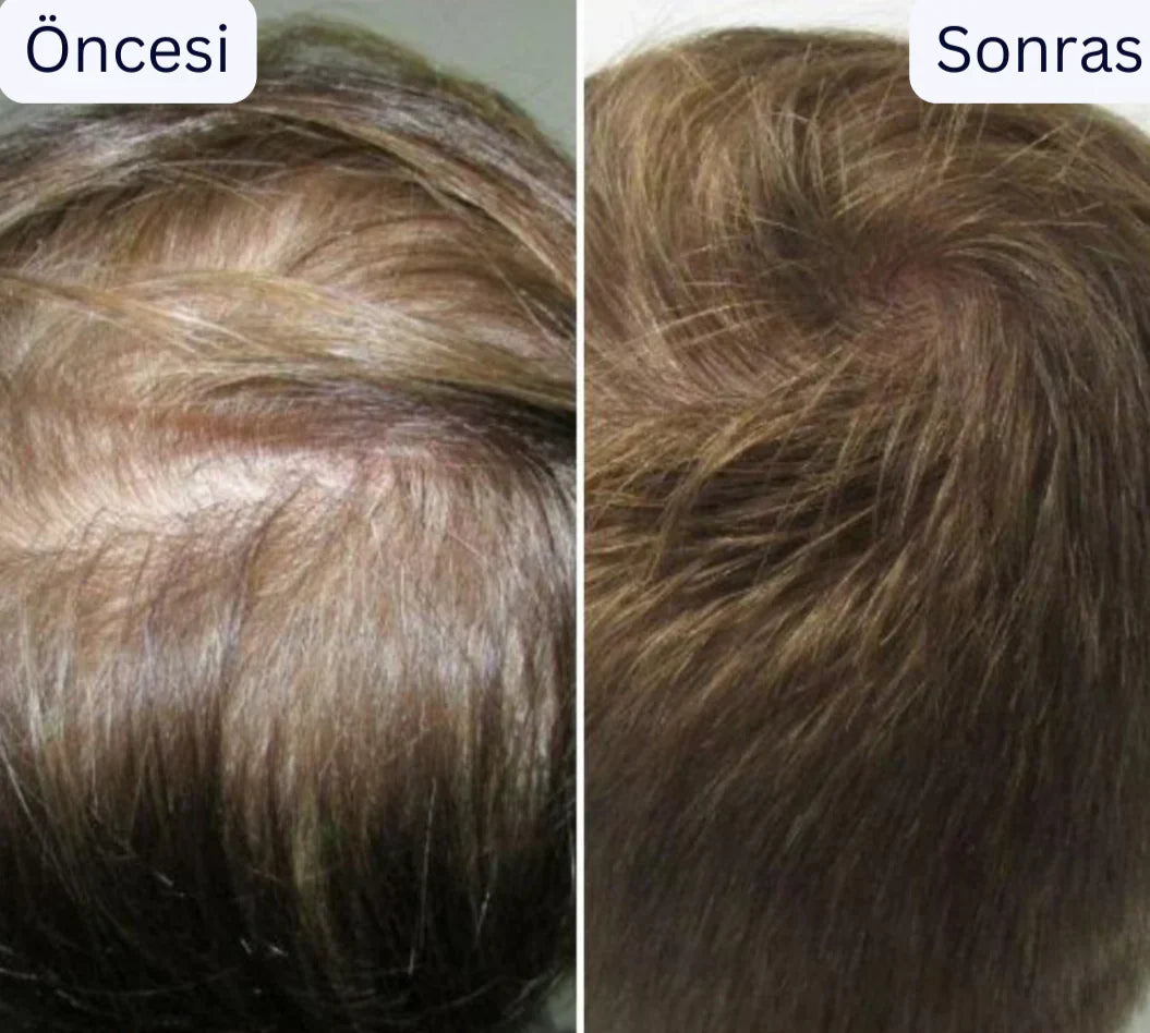 Ortopedya™ Saç Derisi Masaj aleti