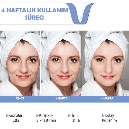 Ortopedya™ Beauty Face Lifting Cihazı (Gıdılara Elveda)