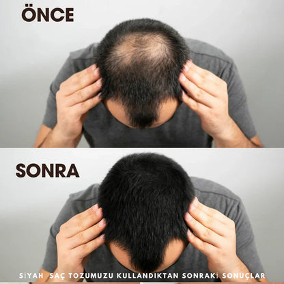 Ortopedya™ Root'd™ Saç Kök Güçlendirici Kapatıcı Pudra (48 Saat Kalıcı Etki)